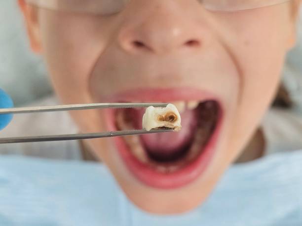 Best Weekend Emergency Dentist in La Plata, MO