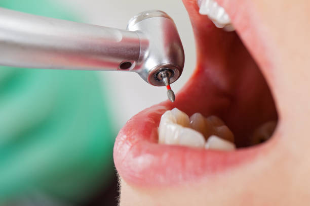 Best Emergency Treatment for Toothache in La Plata, MO